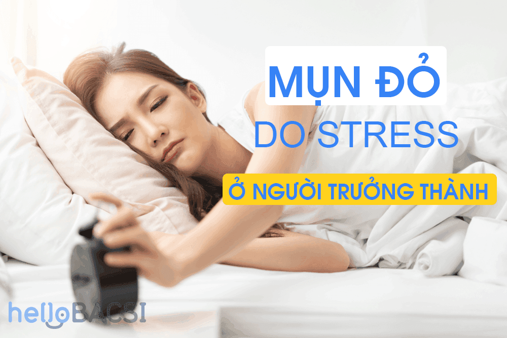 Mụn Đỏ và Căng Thẳng: Nguyên Nhân, Biểu Hiện và Giải Pháp Chống Mụn Hiệu Quả