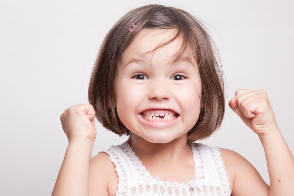 Răng mọc lẫy: Hiểu rõ nguyên nhân, cách điều trị và phòng ngừa