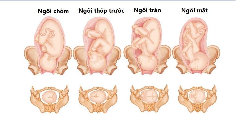 Ngôi thai thuận: Dấu hiệu, Cách nhận biết và Giải pháp nếu bé không quay đầu