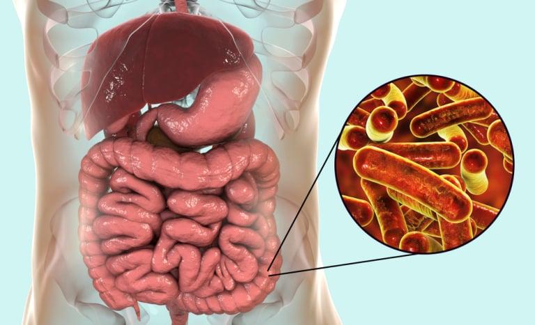 Bệnh Lỵ Trực Trùng: Nguyên Nhân, Triệu Chứng, Chẩn Đoán và Phòng Ngừa