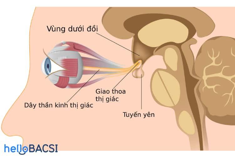 Hiểu biết toàn diện về Ung thư tuyến yên: Triệu chứng, Nguyên nhân, Chẩn đoán và Điều trị