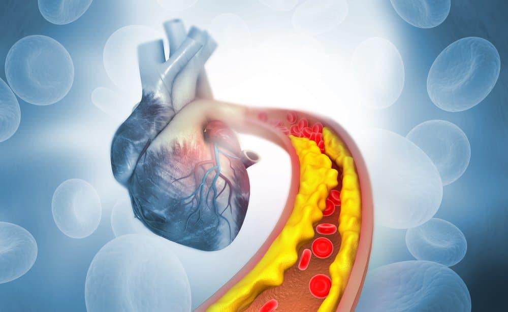 Surotadina: Thuốc Ức Chế HMG-CoA Reductase Trong Điều Trị Tăng Cholesterol Máu