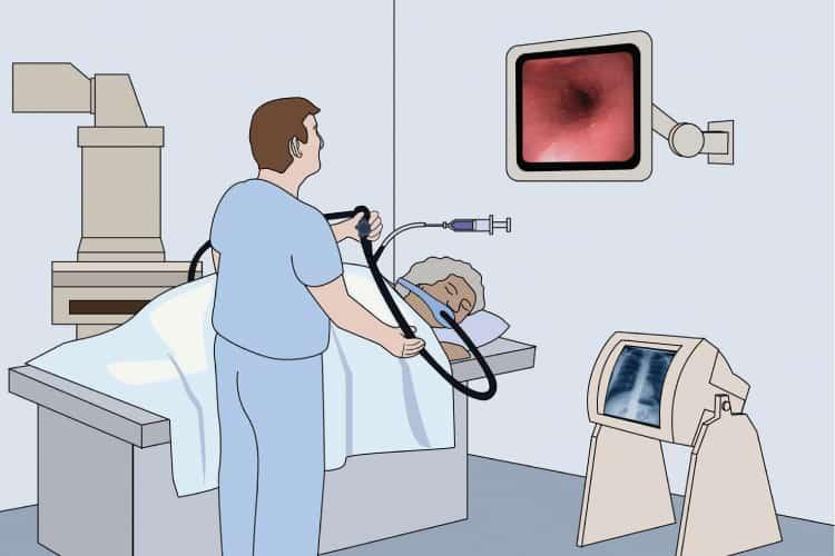 Nội soi mật tụy ngược dòng (ERCP): Hướng dẫn toàn diện