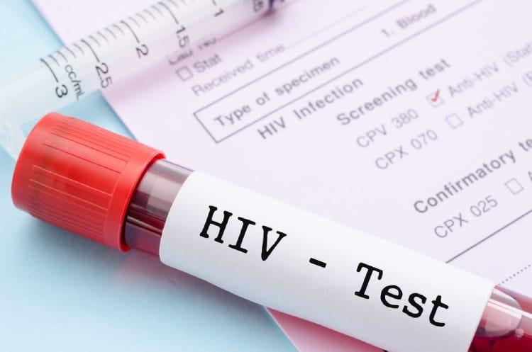 Phòng ngừa HIV/AIDS: Hướng dẫn toàn diện