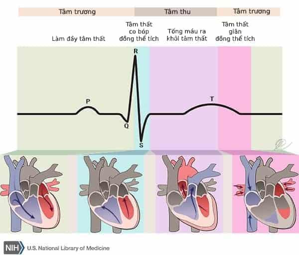 Hội chứng QT Ngắn: Nguyên nhân, Triệu chứng, Chẩn đoán và Điều trị