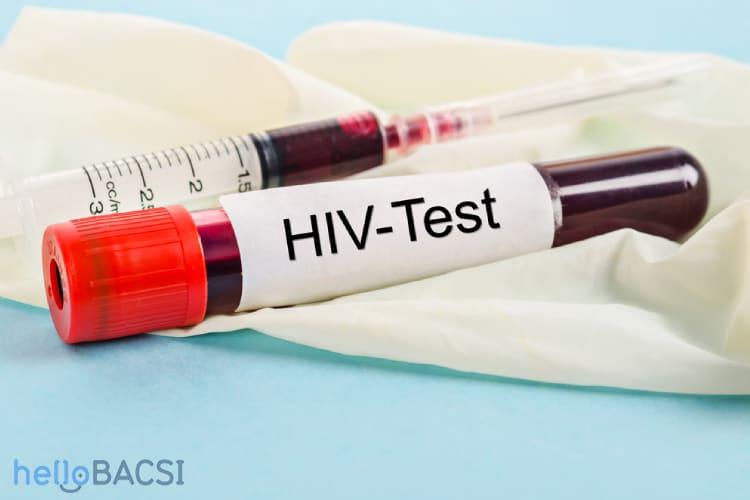 Xét nghiệm HIV: Toàn bộ hướng dẫn về cách thức hoạt động, các loại xét nghiệm và giải thích kết quả